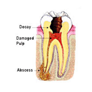 drawing of tooth