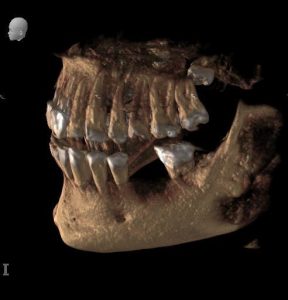 CBCT image